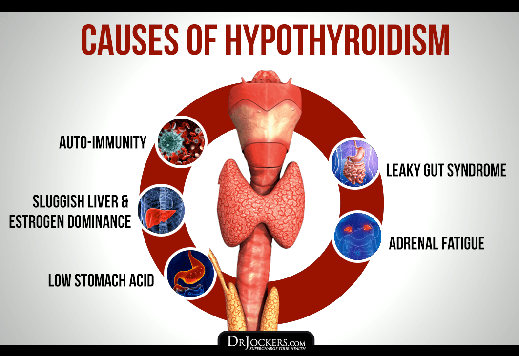 Hypothyroidism nutrition, The Hypothyroidism Nutrition Plan
