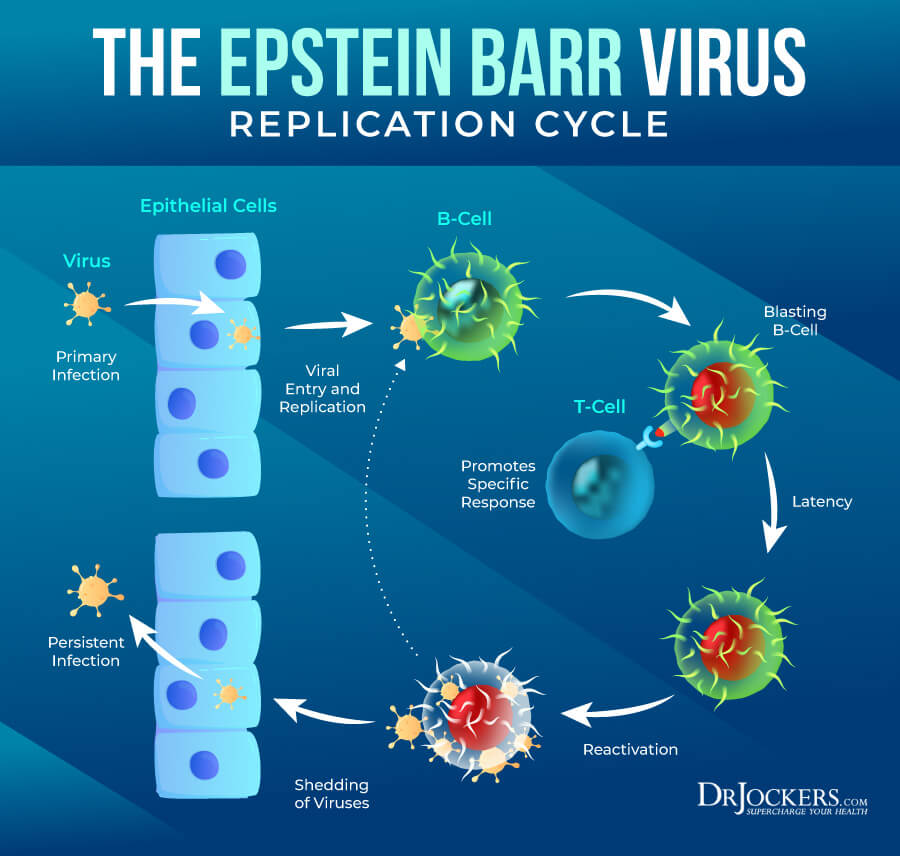 Epstein Barr, Epstein Barr Virus:  Symptoms, Causes and Support Strategies
