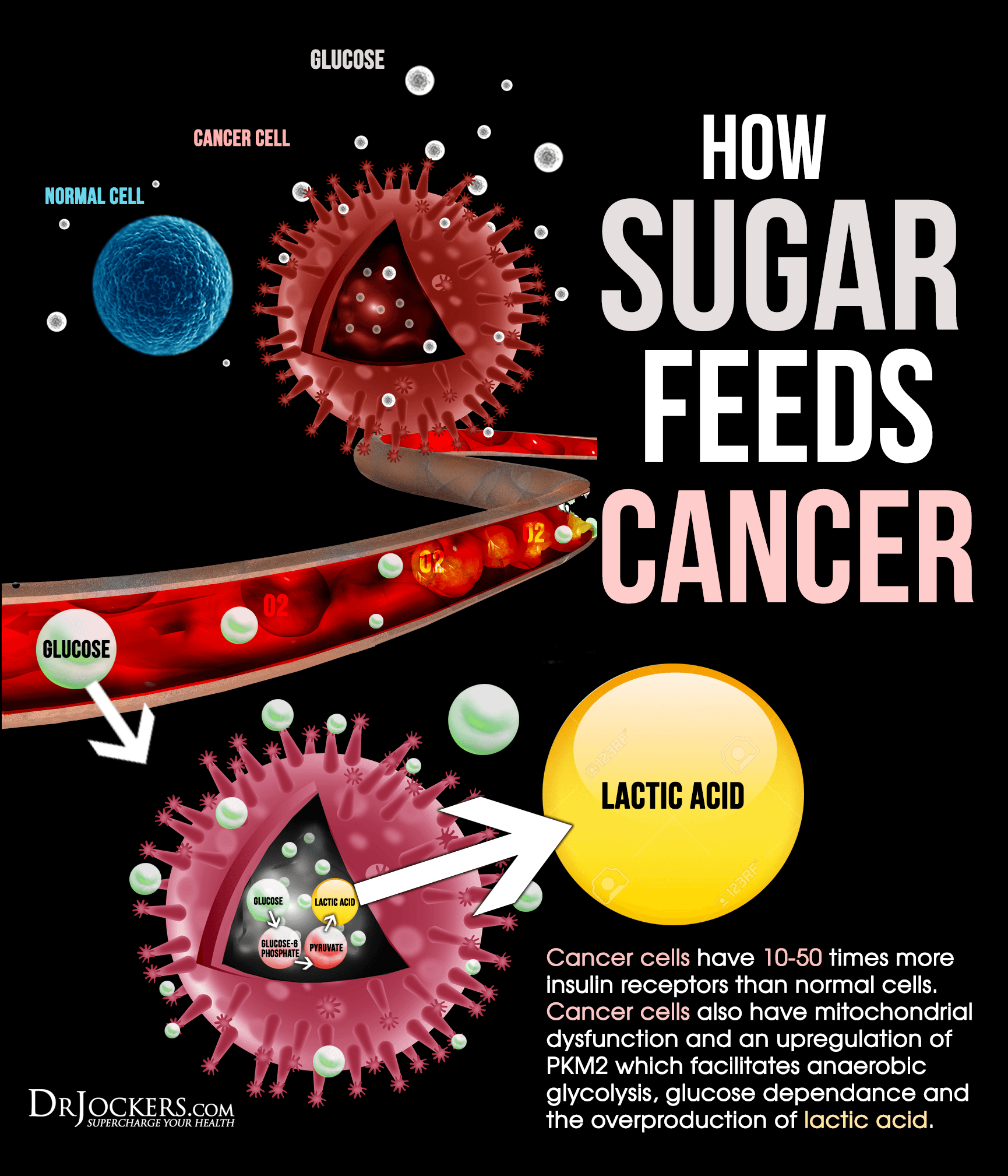 Sugar and cancer – what you need to know