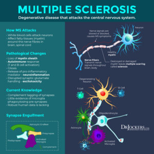Multiple Sclerosis: Causes, Symptoms & Natural Support Strategies