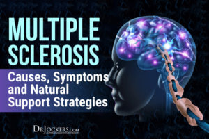 Multiple Sclerosis: Causes, Symptoms & Natural Support Strategies