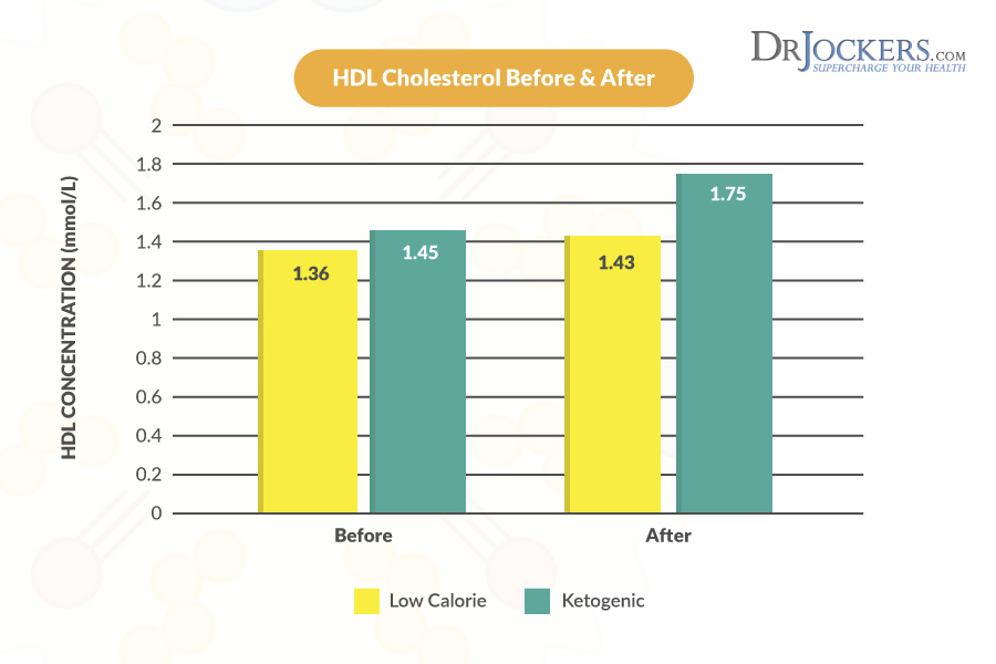 High Cholesterol, High Cholesterol on a Ketogenic Diet
