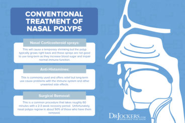 Nasal Polyps: Symptoms, Causes And Natural Support Strategies