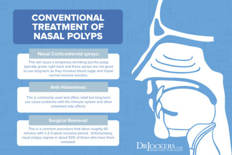 Nasal Polyps: Symptoms, Causes and Natural Support Strategies