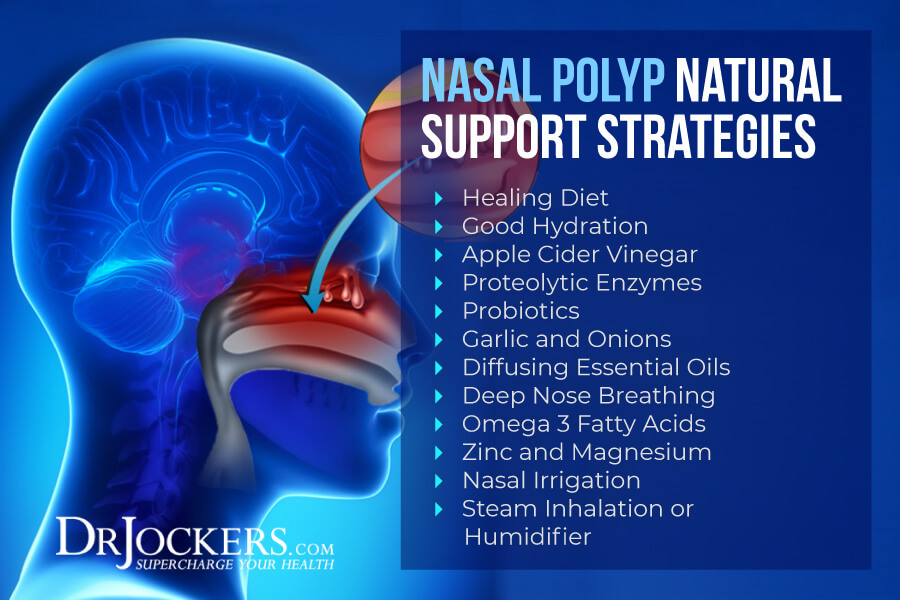 Nasal Polyps, Nasal Polyps:  Symptoms, Causes and Natural Support Strategies