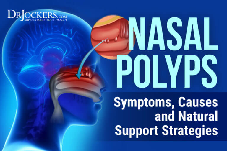 Nasal Polyps Symptoms Causes And Natural Support Strategies 5135