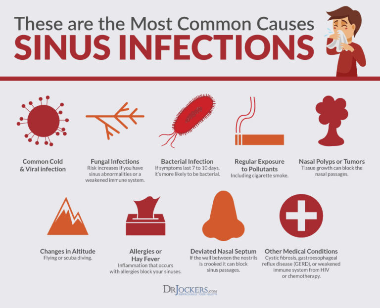 Sinus infections causes symptoms natural support strategies