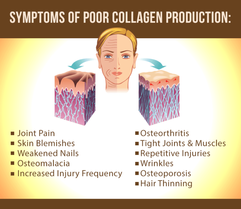 Collagen 9 Reasons Why This Improves Your Health
