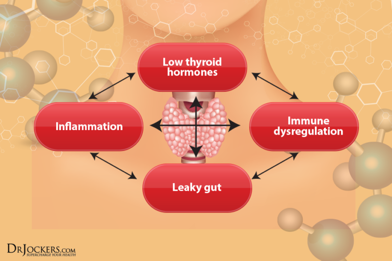 5 Natural Remedies For Thyroid Health - DrJockers.com