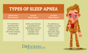 Sleep Apnea: Symptoms, Causes and Natural Support Strategies