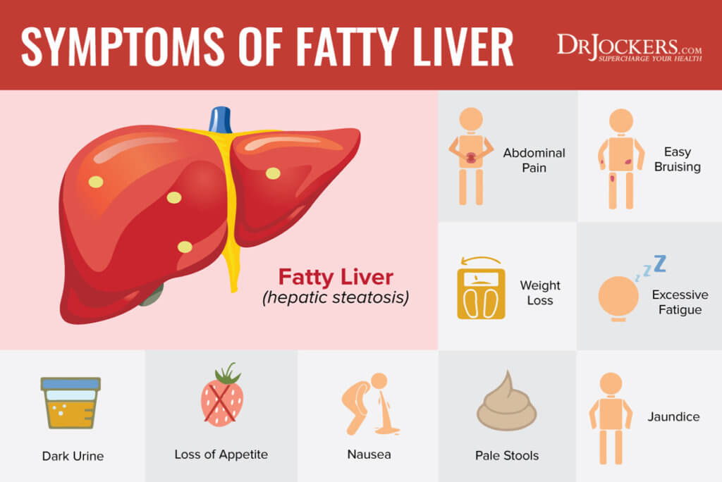 Fatty Liver: Symptoms, Causes and Natural Support Strategies