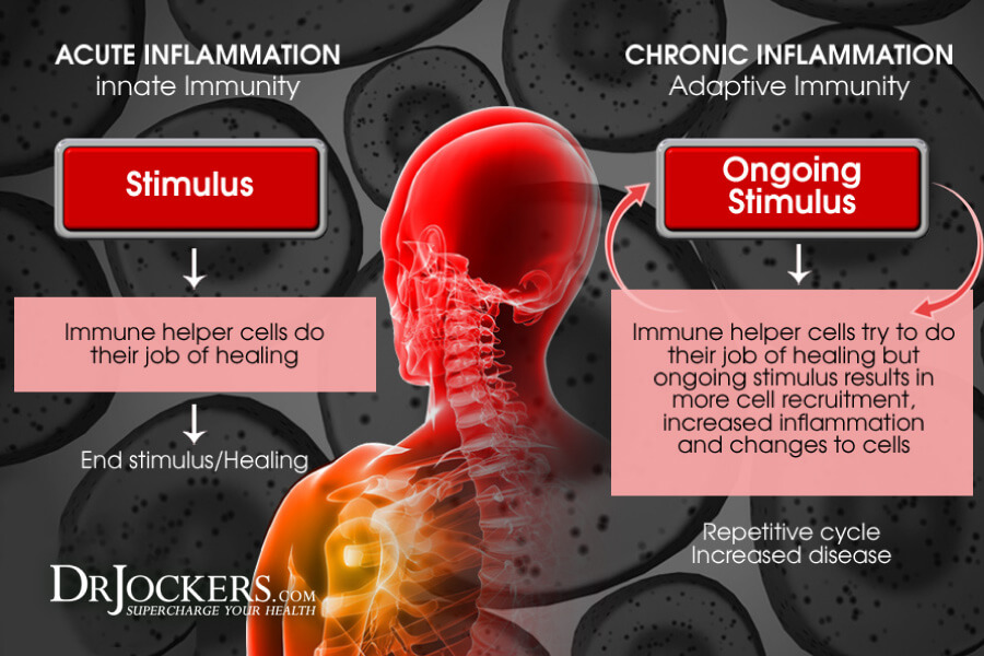 Inflammation, 5 Ways To Reduce Inflammation Quickly