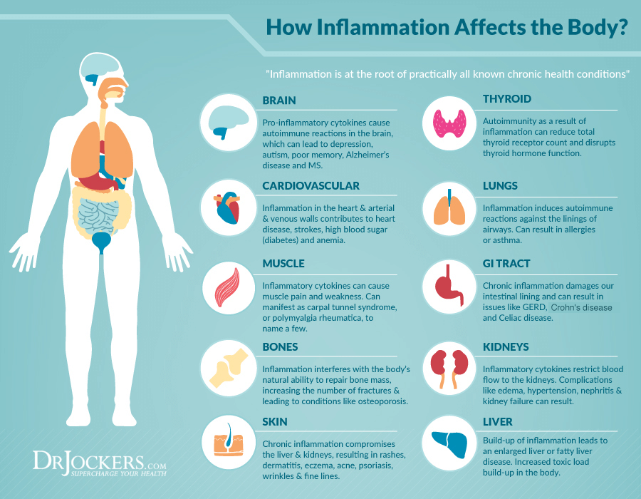 Chronic Inflammation, Top 7 Strategies to Support Chronic Inflammation