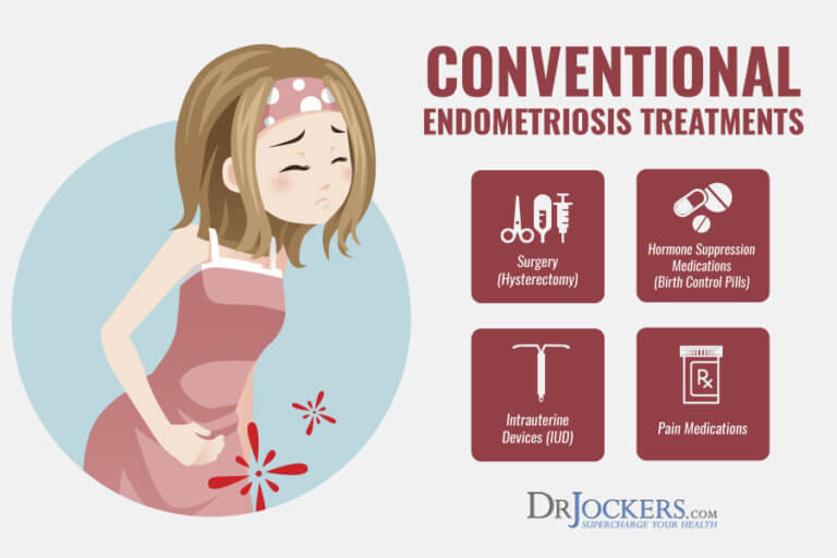 Endometriosis Symptoms, Causes and Natural Support Strategies
