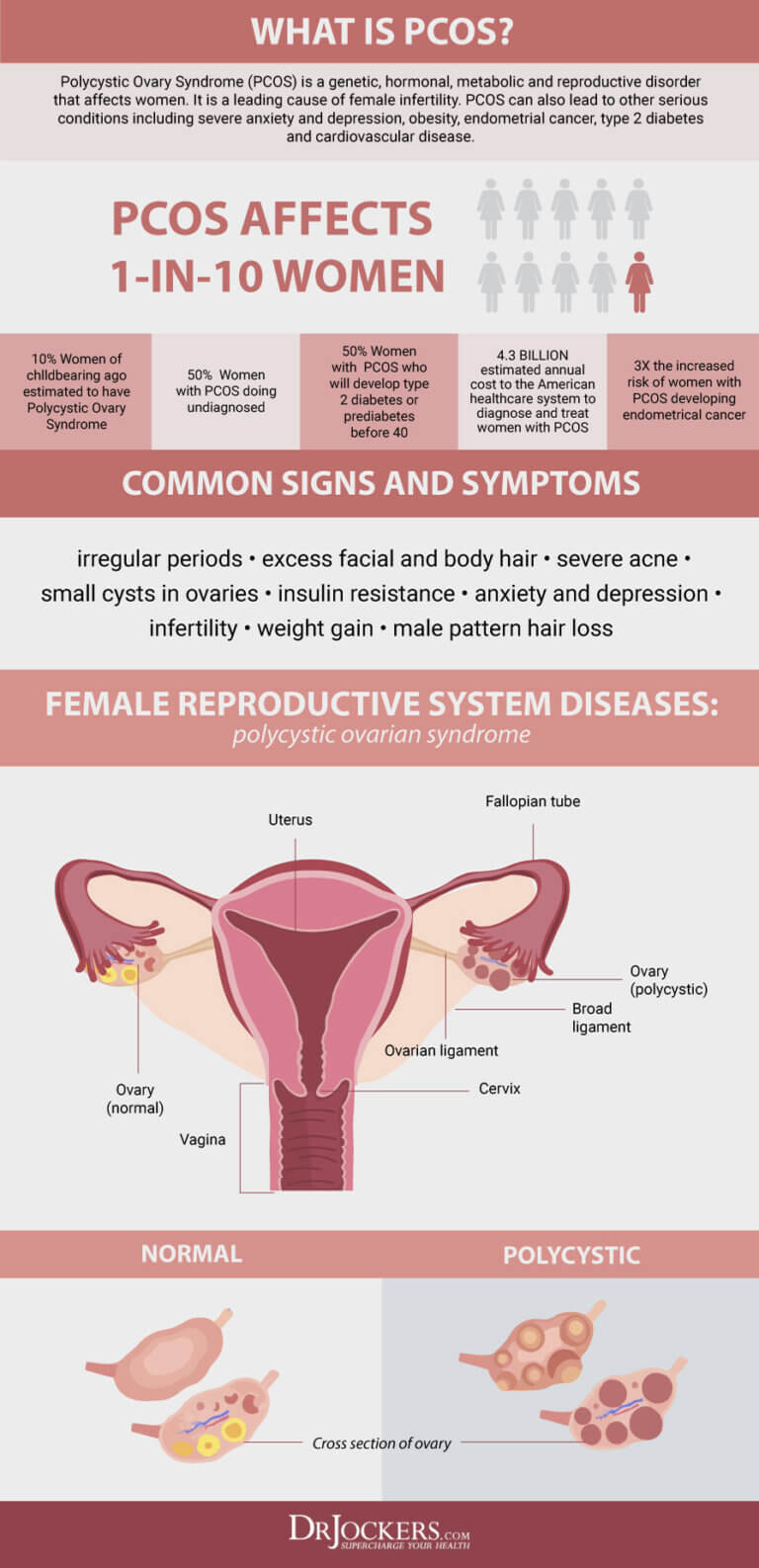 Endometriosis: Symptoms, Causes and Natural Support Strategies