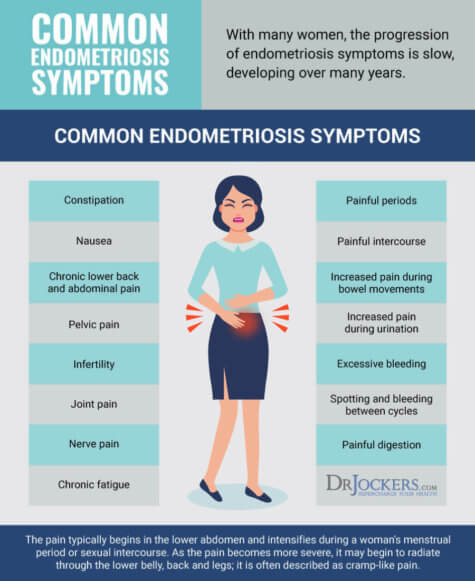 Endometriosis: Symptoms, Causes and Natural Support Strategies