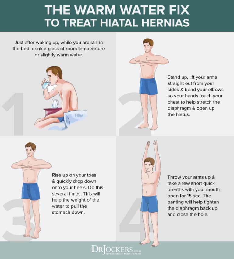 Hiatal Hernia Symptoms, Causes and Natural Support Strategies