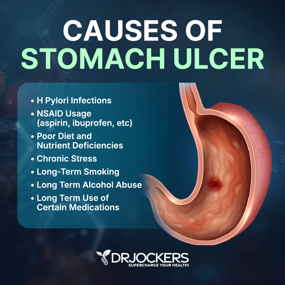 stomach ulcer