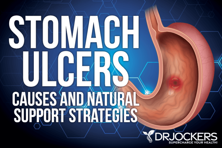 Stomach Ulcers Causes And Natural Support Strategies 