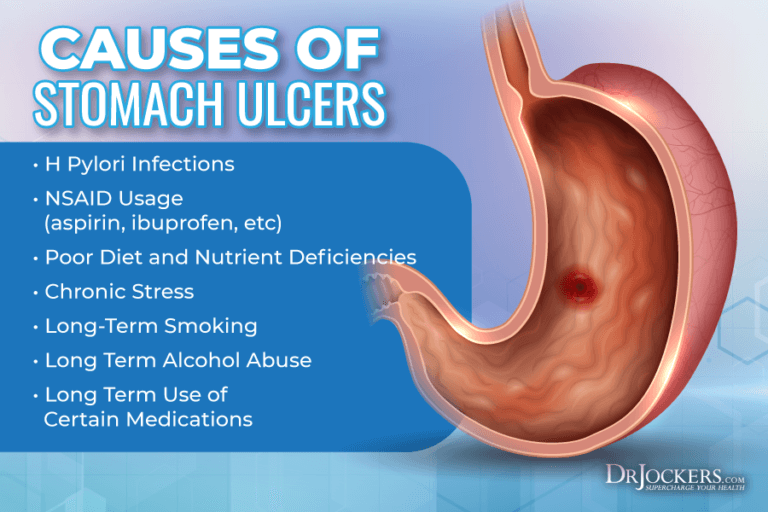 Stomach Ulcers Causes And Natural Support Strategies 