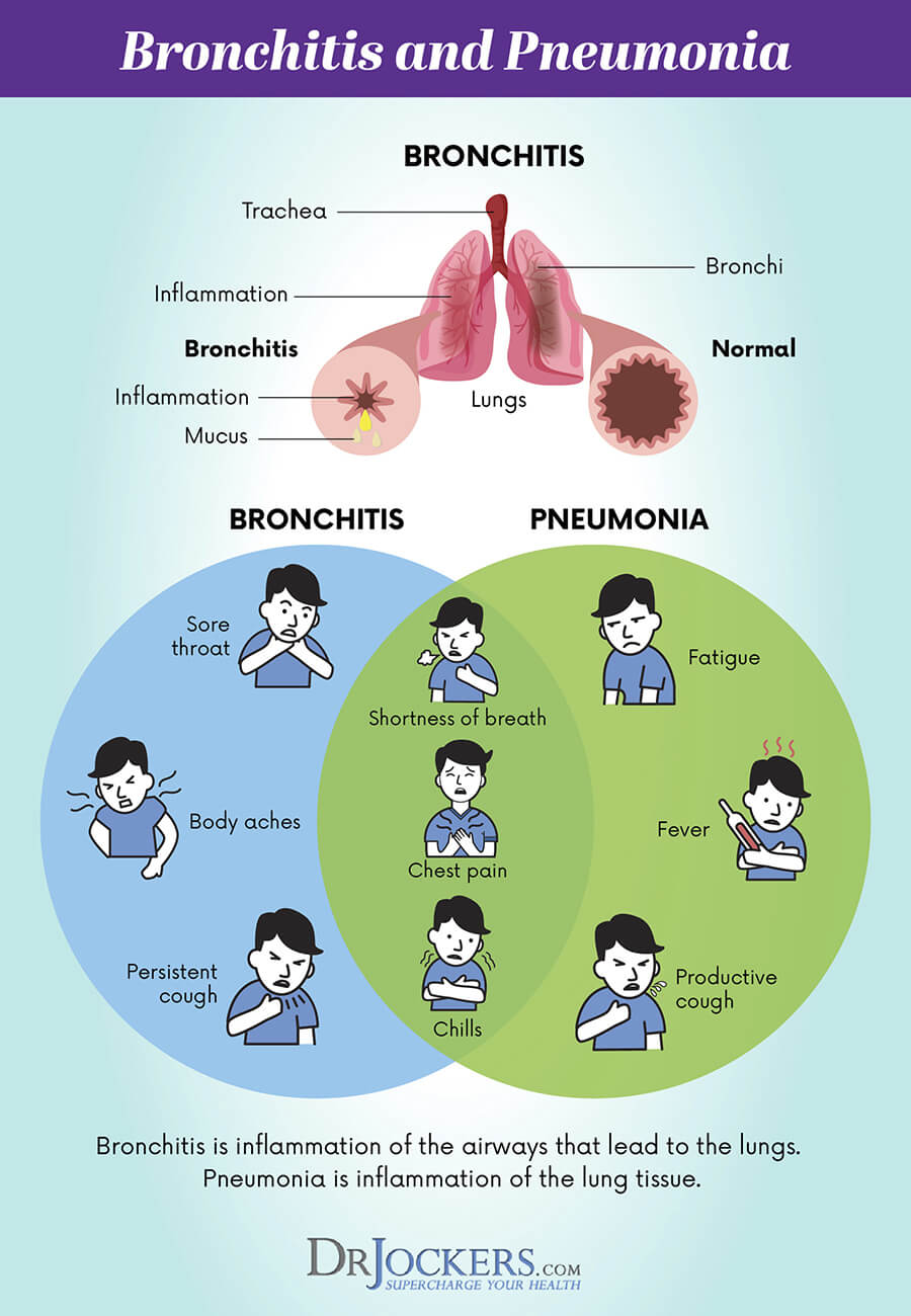 Bronchitis, Bronchitis: Causes, Symptoms and Solutions