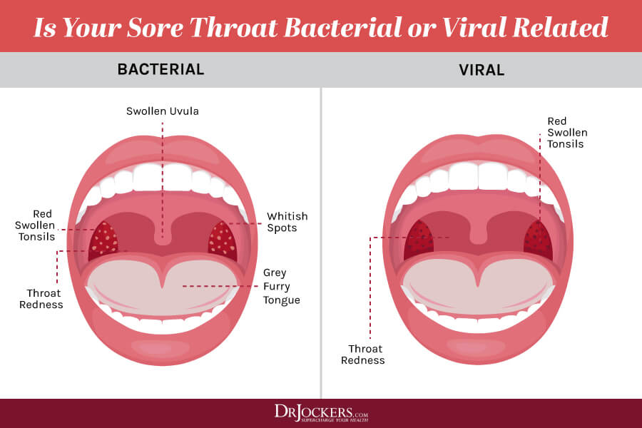 sore throat, Top 10 Ways to Overcome a Sore Throat