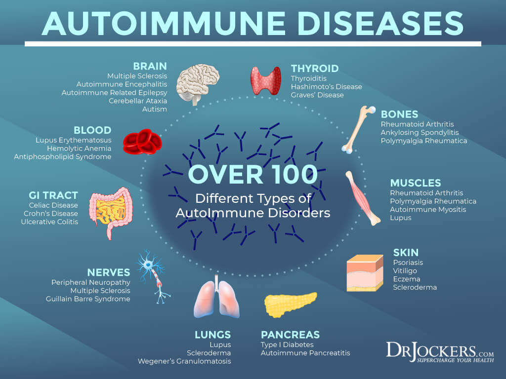 autoimmune conditions, The 7 Major Factors Causing AutoImmune Conditions
