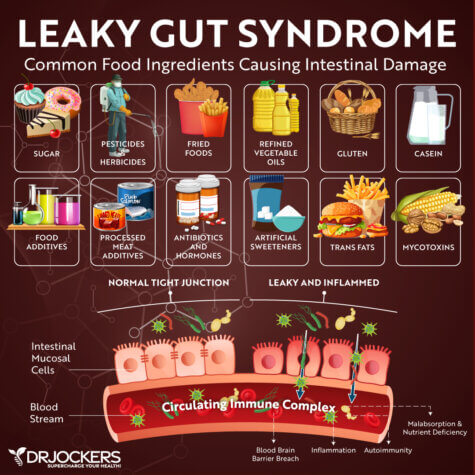 Irritable Bowel Syndrome: 8 Strategies to Heal Your Gut - DrJockers.com