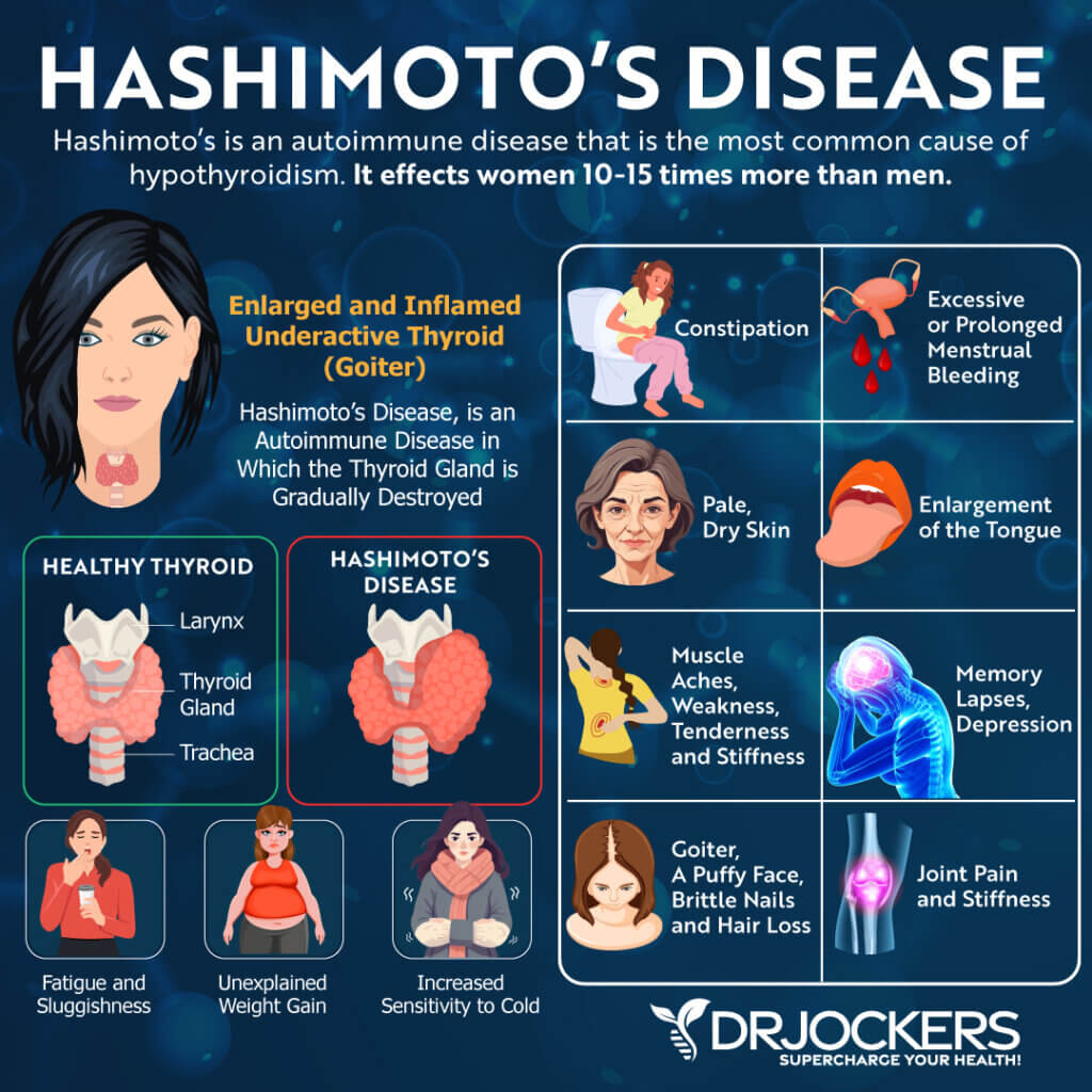 Hashimoto's Thyroiditis: Causes, Symptoms and Support Strategies