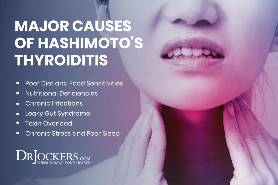 Hashimoto's, Hashimoto&#8217;s Thyroiditis:  Causes, Symptoms and Support Strategies