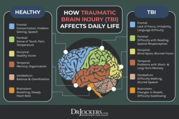 Concussion Protocol: Symptoms and Healing Strategies - DrJockers.com