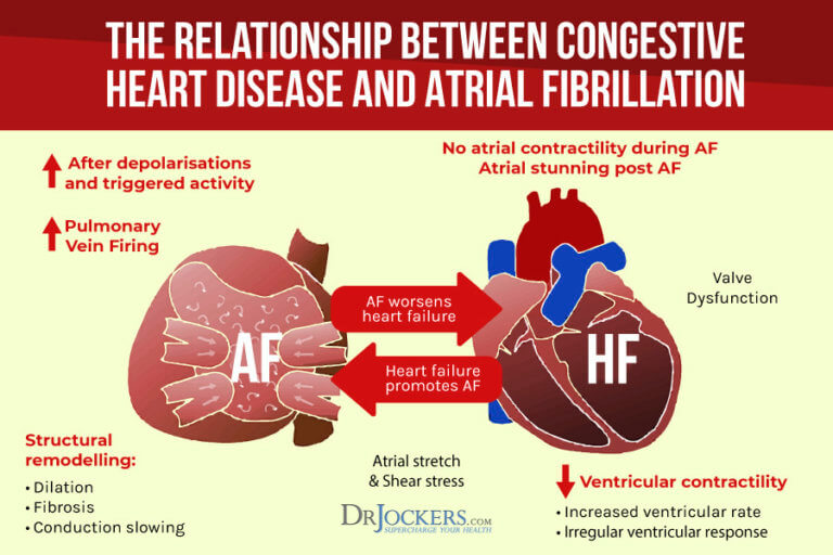 Atrial Fibrillation: Causes, Symptoms & Natural Support Strategies