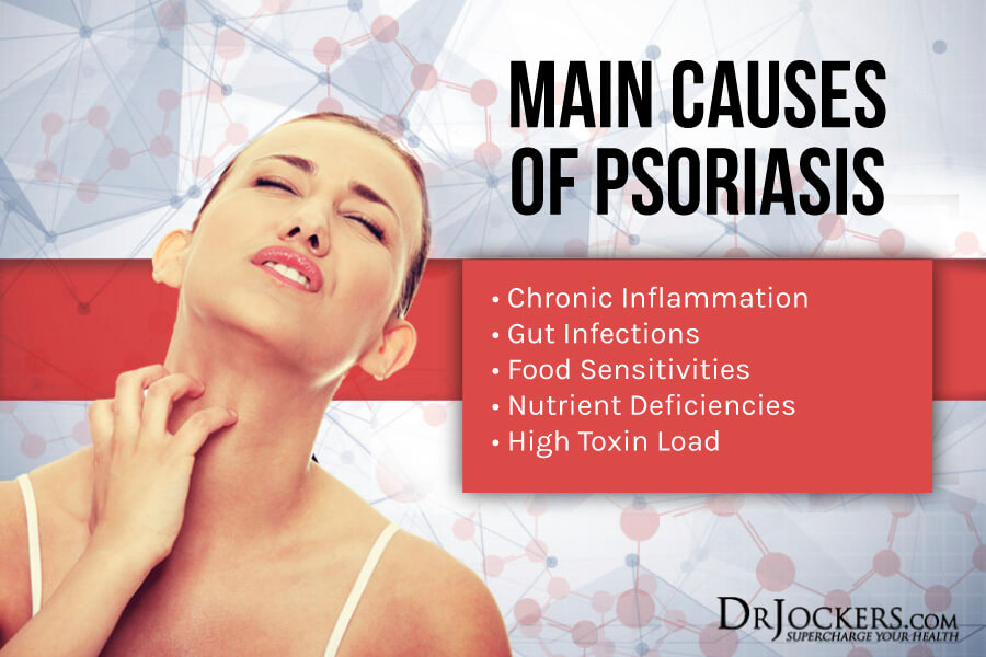 Psoriasis, Psoriasis:  Causes, Symptoms &#038; Natural Support Strategies