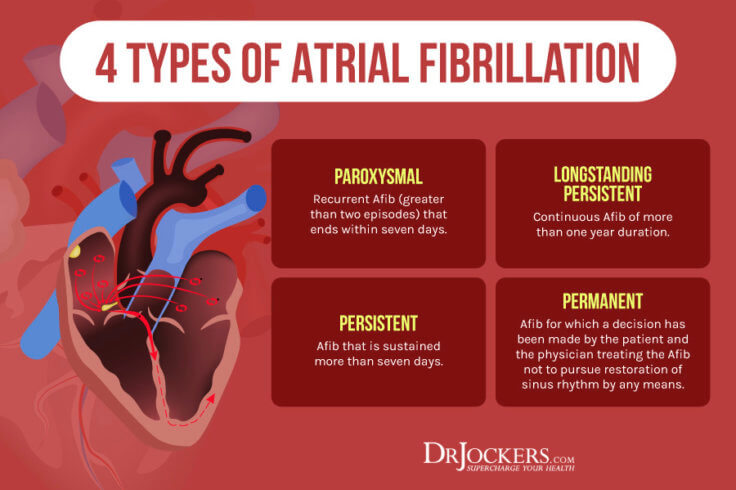 Atrial Fibrillation: Causes, Symptoms & Natural Support Strategies