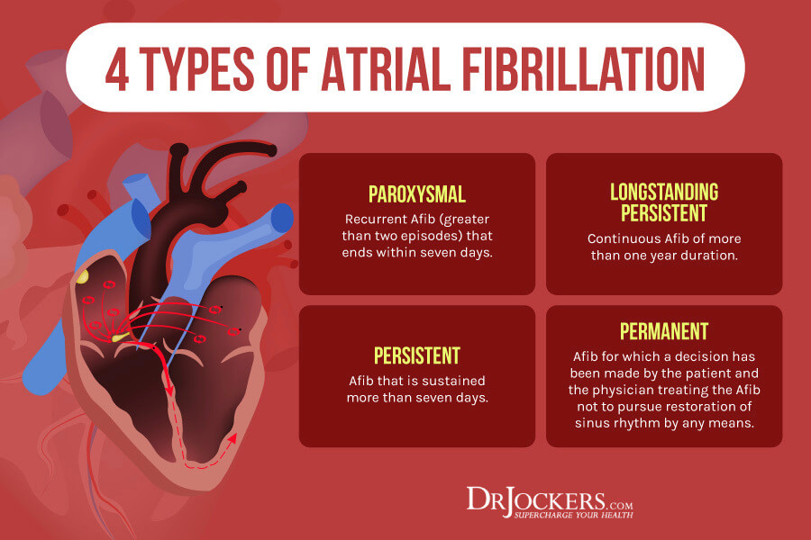 Atrial Fibrillation, Atrial Fibrillation:  Causes, Symptoms &#038; Natural Support Strategies