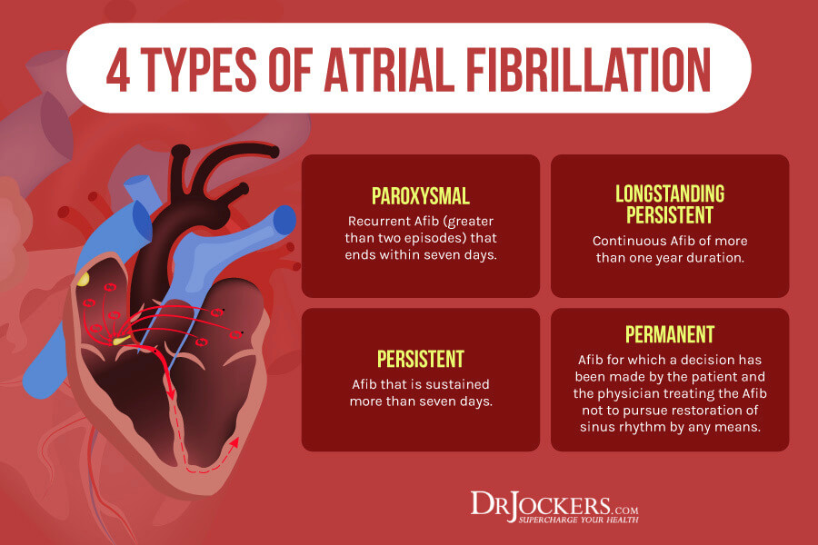 Types Of Afib Chart