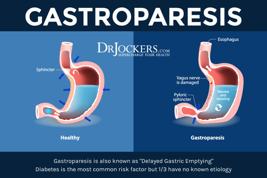 gastroparesis, Gastroparesis: Symptoms, Causes and Healing Strategies