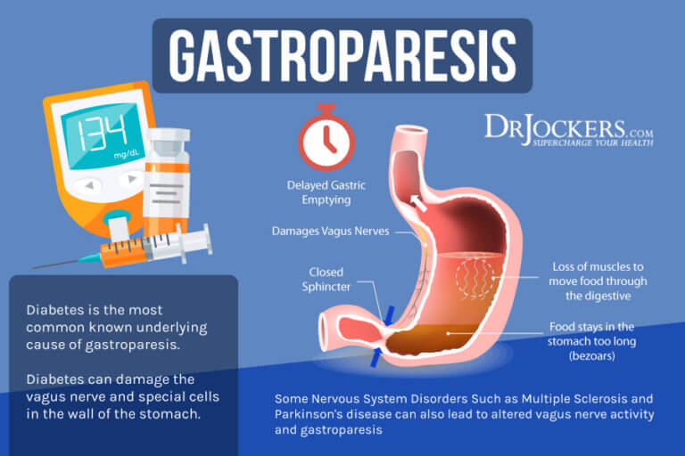 Gastroparesis Symptoms, Causes and Natural Support Strategies