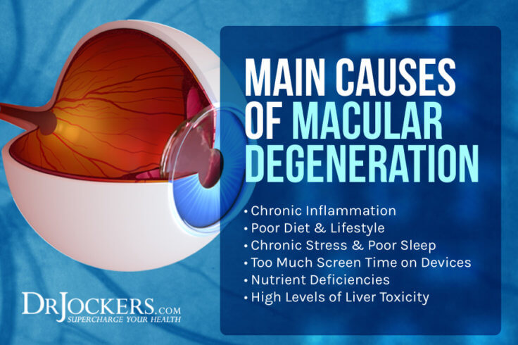 Macular Degeneration: Causes, Symptoms & Natural Strategies