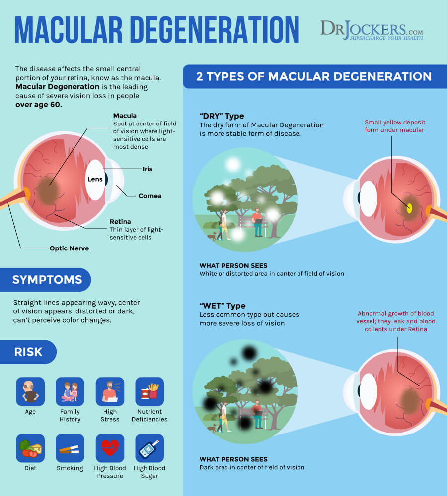 macular degeneration symptoms