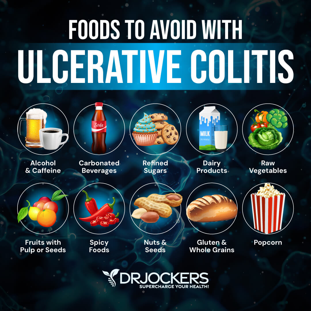 ulcerative colitis
