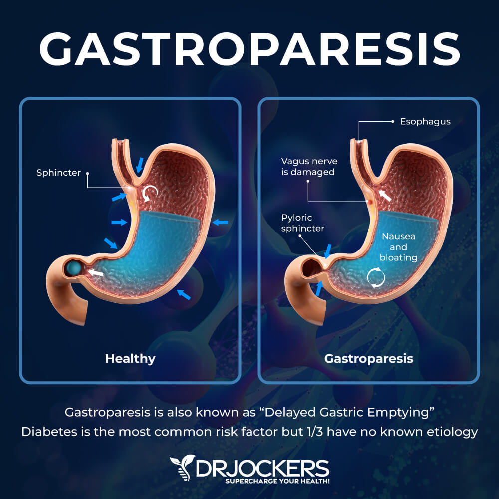 gastroparesis