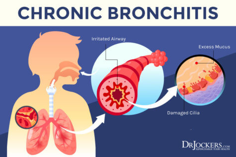 Bronchitis: Causes, Symptoms and Support Strategies - DrJockers.com