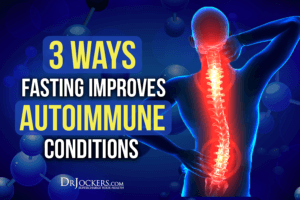 3 Ways Fasting Improves Autoimmune Diseases Drjockers 3 Ways Fasting Improves Autoimmune Diseases Drjockers