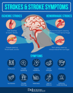 Cerebrovascular Disease: Causes, Symptoms & Support Strategies