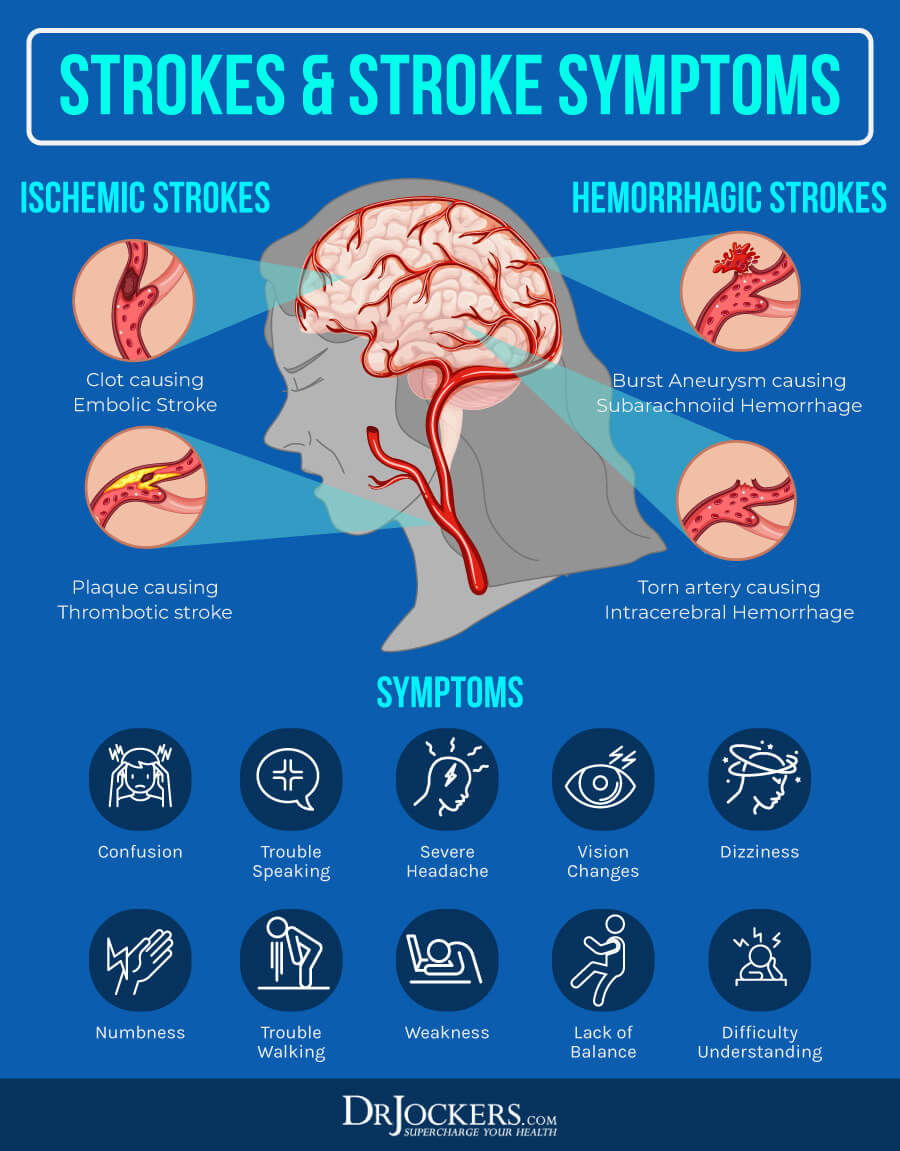 cerebrovascular disease, Cerebrovascular Disease: Causes, Symptoms &#038; Support Strategies