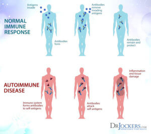 The AutoImmune Nutrition Plan To Reduce Inflammation - DrJockers.com