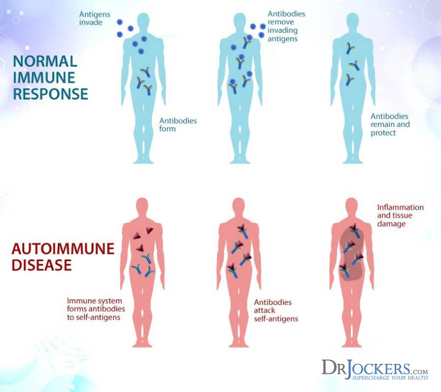 heal autoimmune disease, 5 Steps to Heal Autoimmune Disease