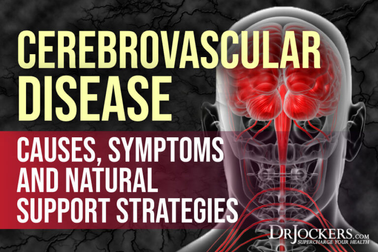 Cerebrovascular Disease Causes Symptoms And Support Strategies