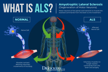 ALS: Symptoms, Causes, and Natural Support Strategies - DrJockers.com